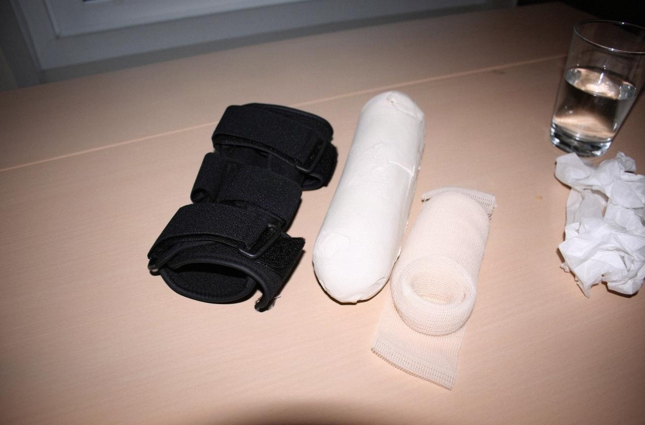 Gips czy orteza po złamaniu: kiedy lekarz wybiera które